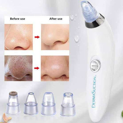 Blackhead Remover Vacuum Acne Cleaner Black Spots Removal.